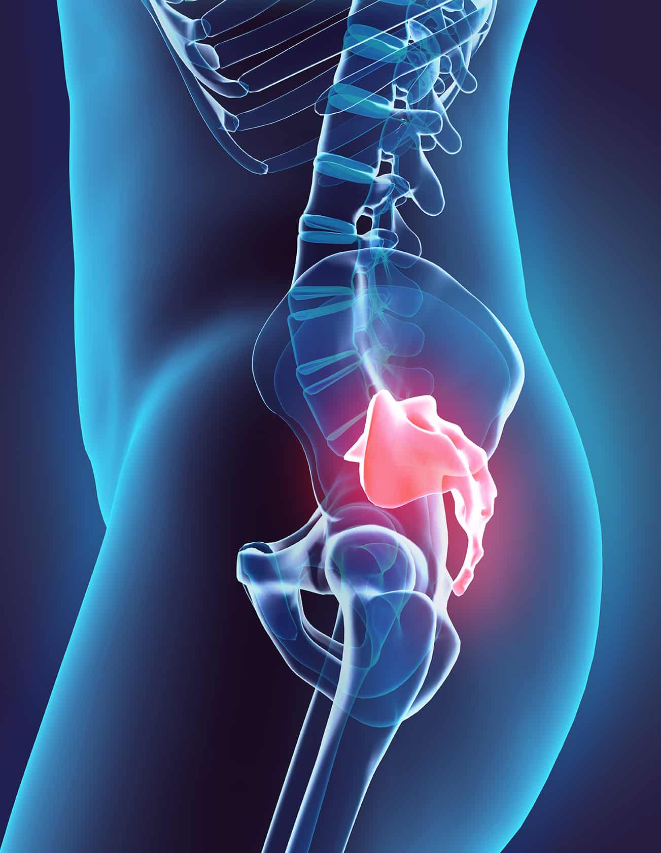 Tailbone Pain or Coccydynia | Spire Orthopaedic