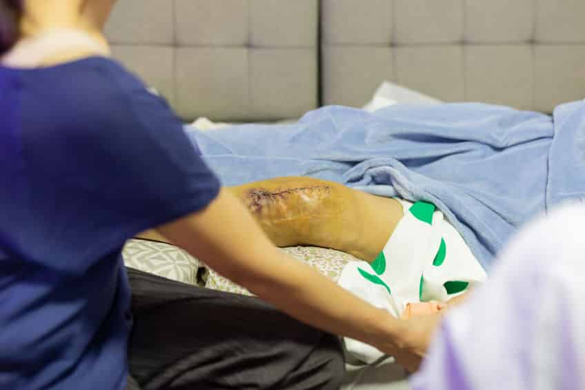 Metal staples used to stitch up skin in knee replacement operati Total knee replacement surgery | Spire Orthopaedic