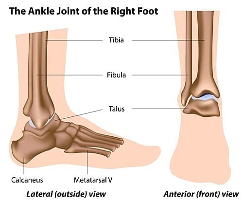 Ankle Fracture in Singapore