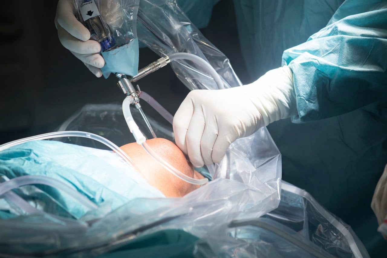 A Beginner's Guide to Robotic-Assisted Knee Replacement
