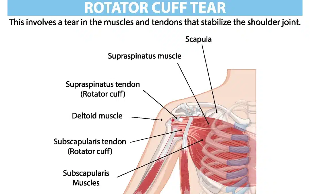 Why Does Shoulder Pain Get Worse at Night?