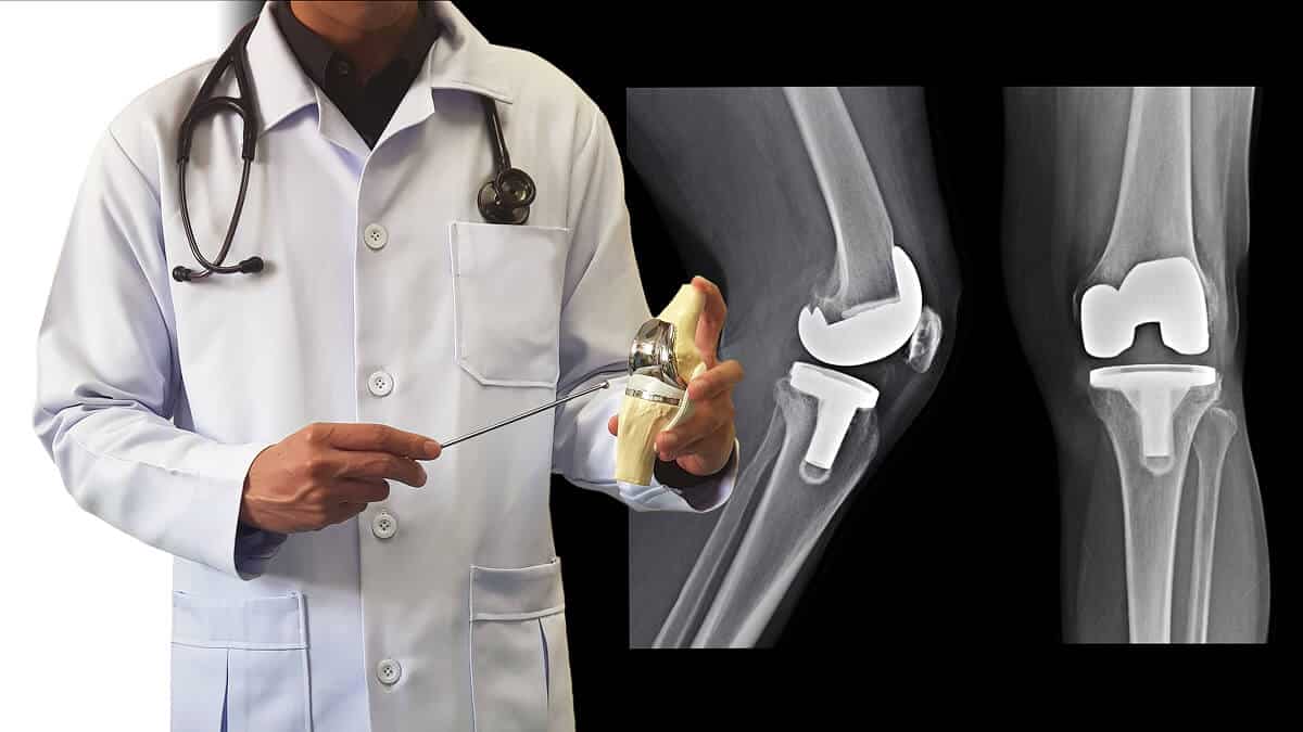 Total Knee Replacement Surgery Preparation Orthopaedic doctor explaining total knee replacement surgery and knee implant preparation - Spire Orthopaedic Centre